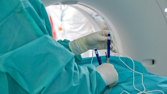 15_04_2026_elektrochemoterapie (5)